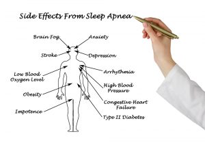 sleep apnea infographic 